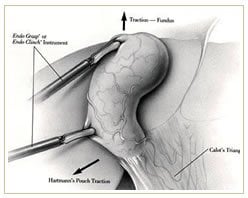 Slider image (5) Panama Gastric Surgery Center